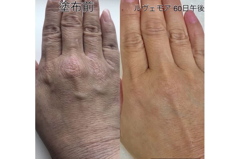 C510E035-F5EB-4981-B41D-199F82C1A1C1